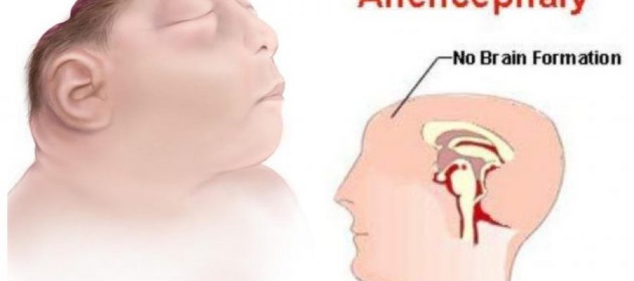 Pre-natal test for Anencephaly