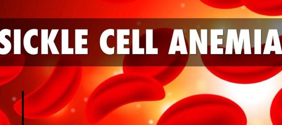 Things that you need to know about sickle cell anemia.